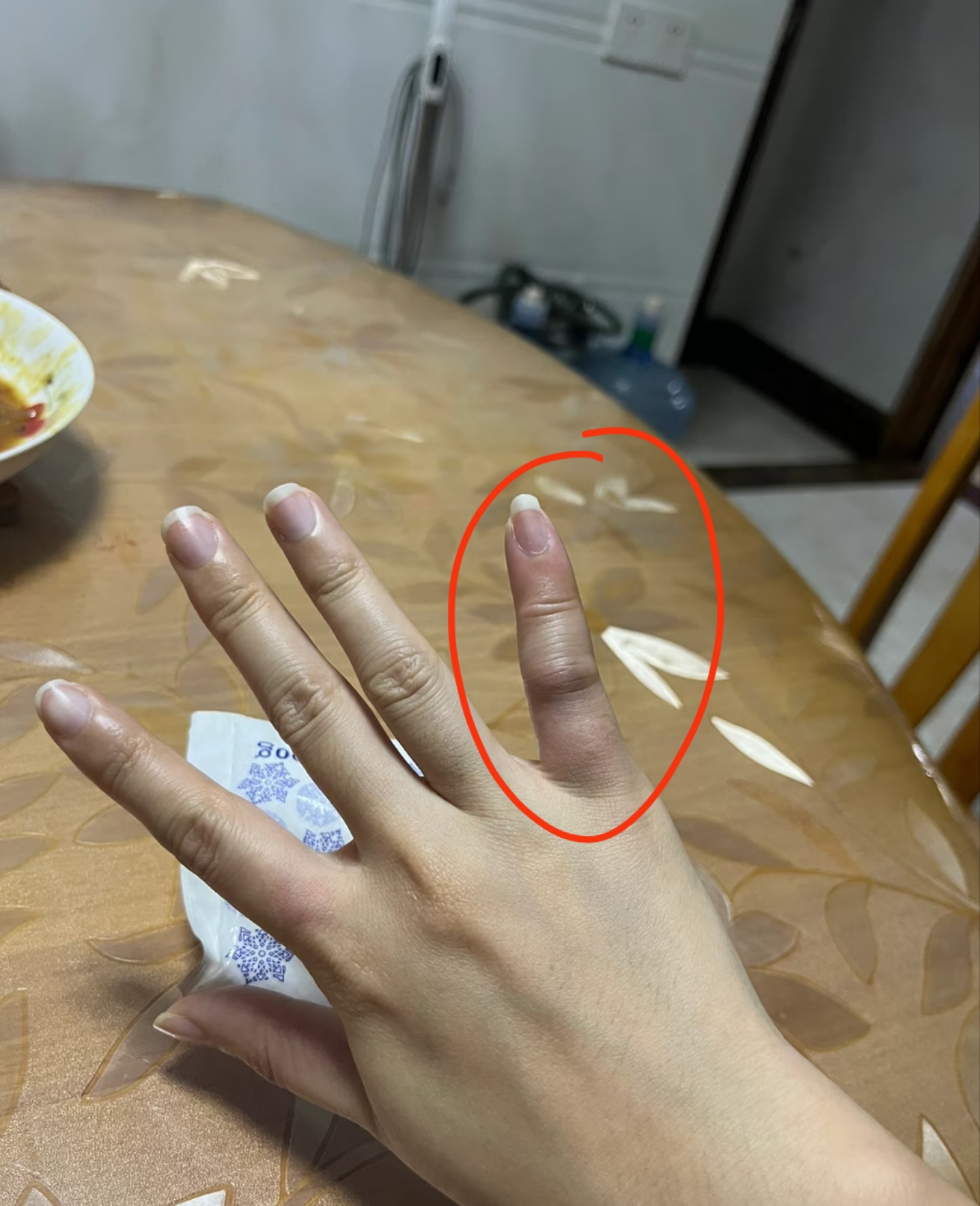 爱游戏体育APP-什么叫刺伤